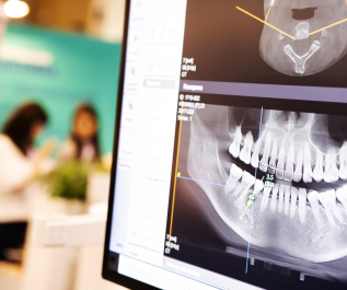 X-ray,Of,The,Jaw,With,Teeth,On,A,Computer,Monitor.