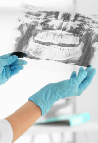 Female,Dentist,Holding,A,Dental,X-ray