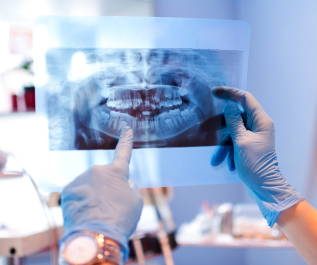 Close-up,Of,Female,Doctor,Pointing,At,Teeth,X-ray,Image,At